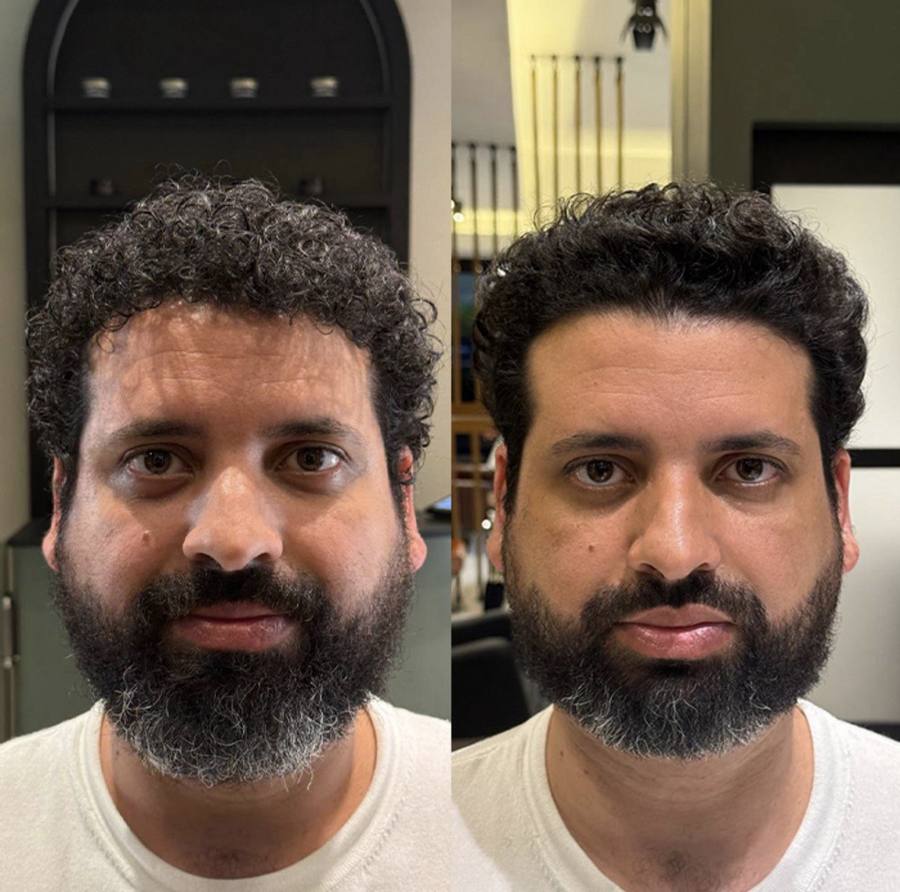 Antes e depois — Caso 01 · Leitura de Presença