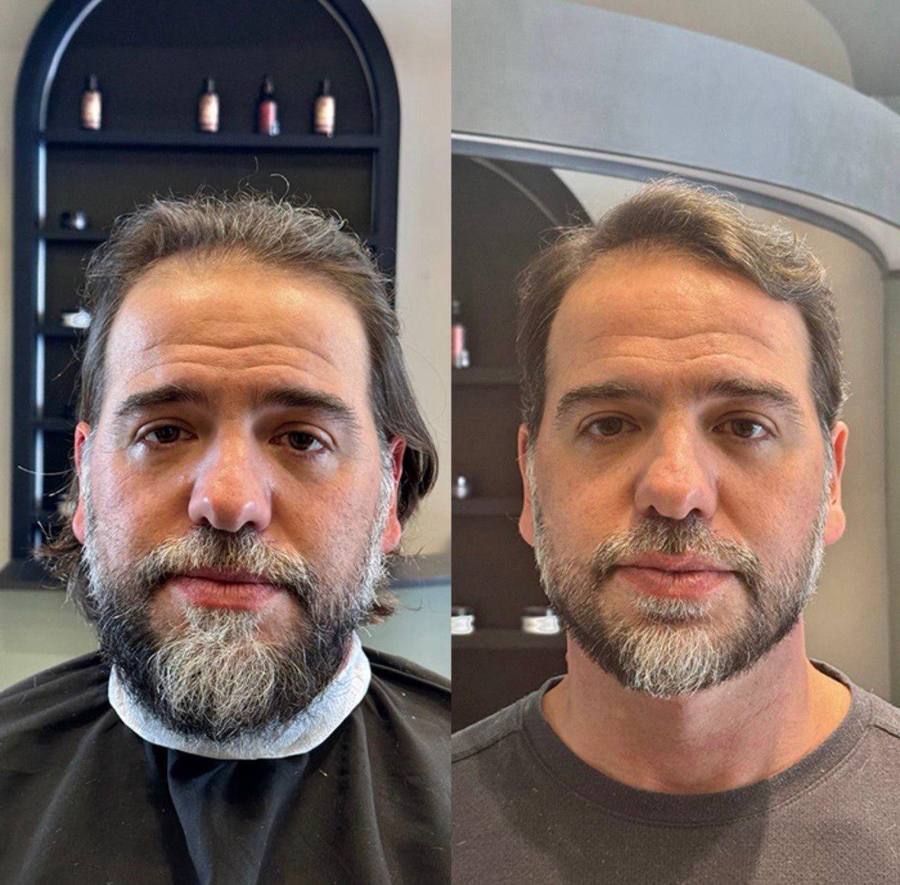 Antes e depois — Caso 02 · Arquétipo de Presença