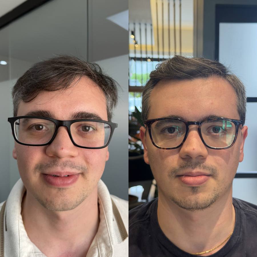 Antes e depois — Caso 03 · Visagismo